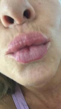 Public Photo of Micia_